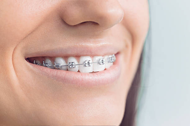 Best Traditional Braces  in Rancho Tehama Reserve, CA